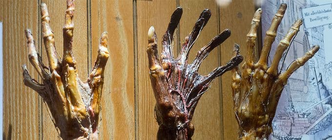 The 12 Creepiest Exhibits at Philadelphia’s Mütter Museum of Medical Oddities