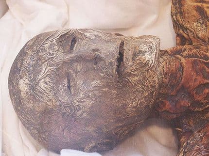 Philippi’s Mummies of the Insane